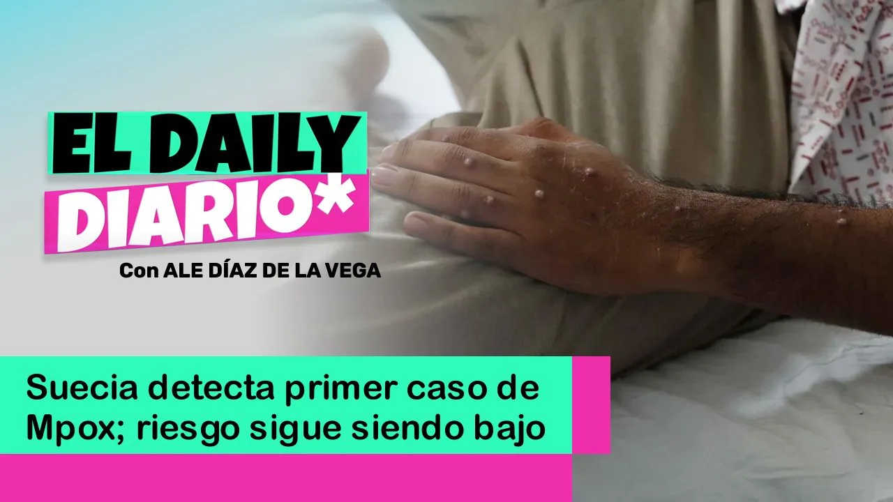 Lee más sobre el artículo Suecia detecta primer caso de Mpox; riesgo sigue siendo bajo