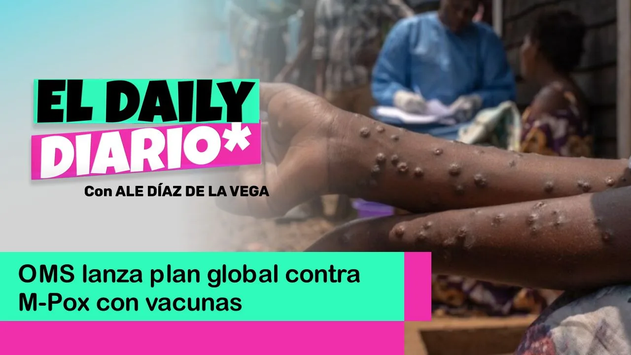 Lee más sobre el artículo OMS lanza plan global contra M-Pox con vacunas