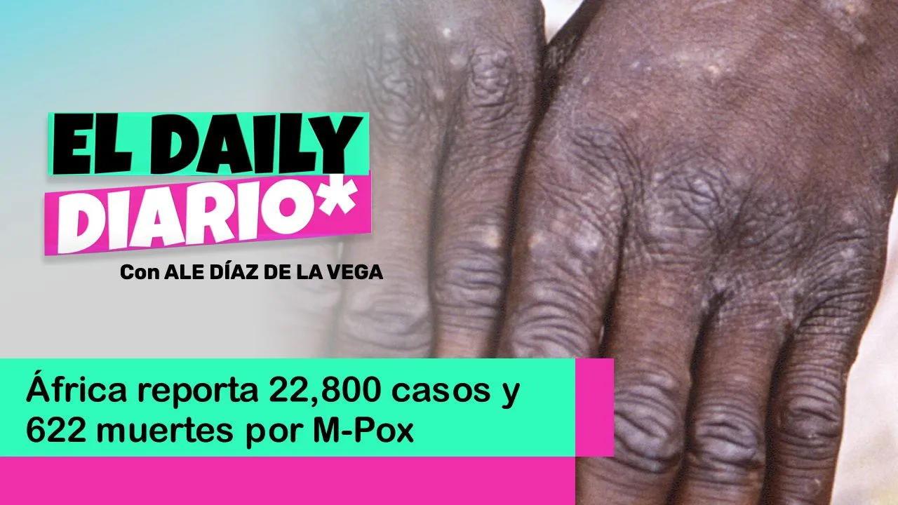 Lee más sobre el artículo África reporta 22,800 casos y 622 muertes por M-Pox