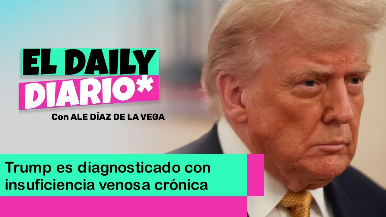 Lee más sobre el artículo Trump es diagnosticado con insuficiencia venosa crónica