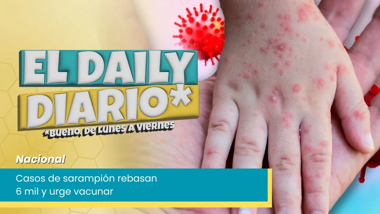 Lee más sobre el artículo Casos de sarampión, urge vacunar