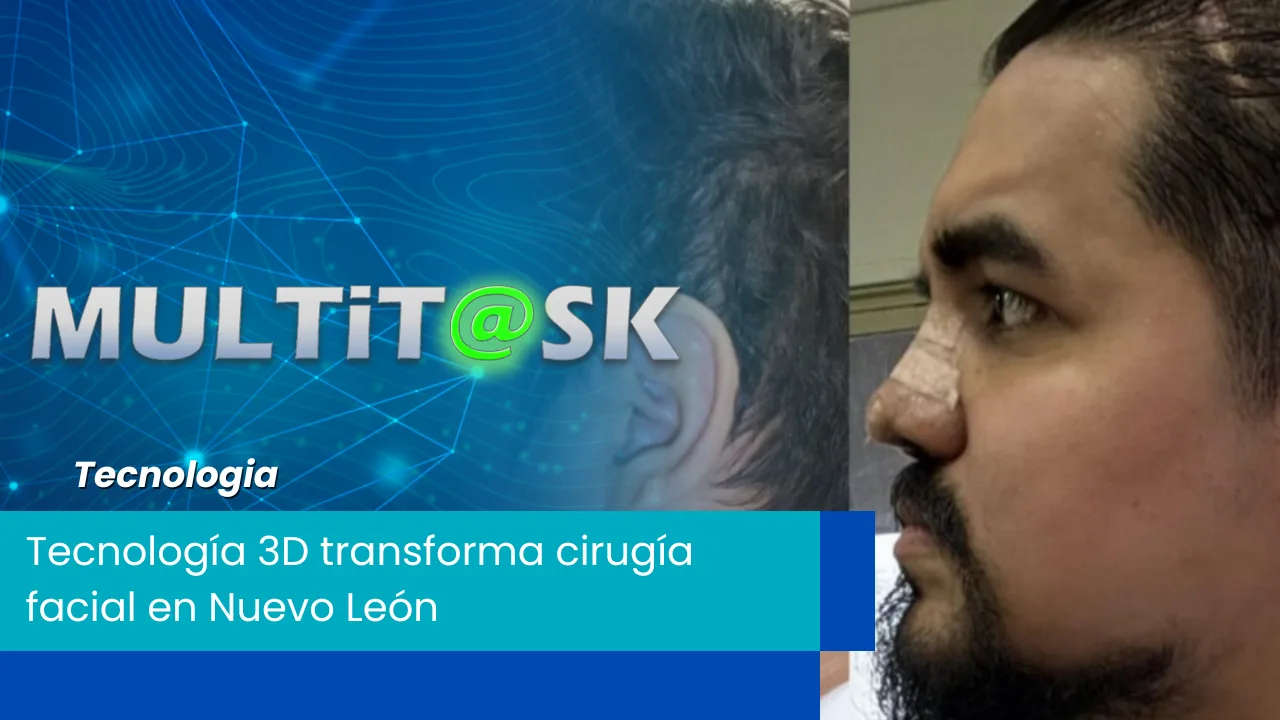 Lee más sobre el artículo Tecnología 3D transforma cirugía facial en Nuevo León